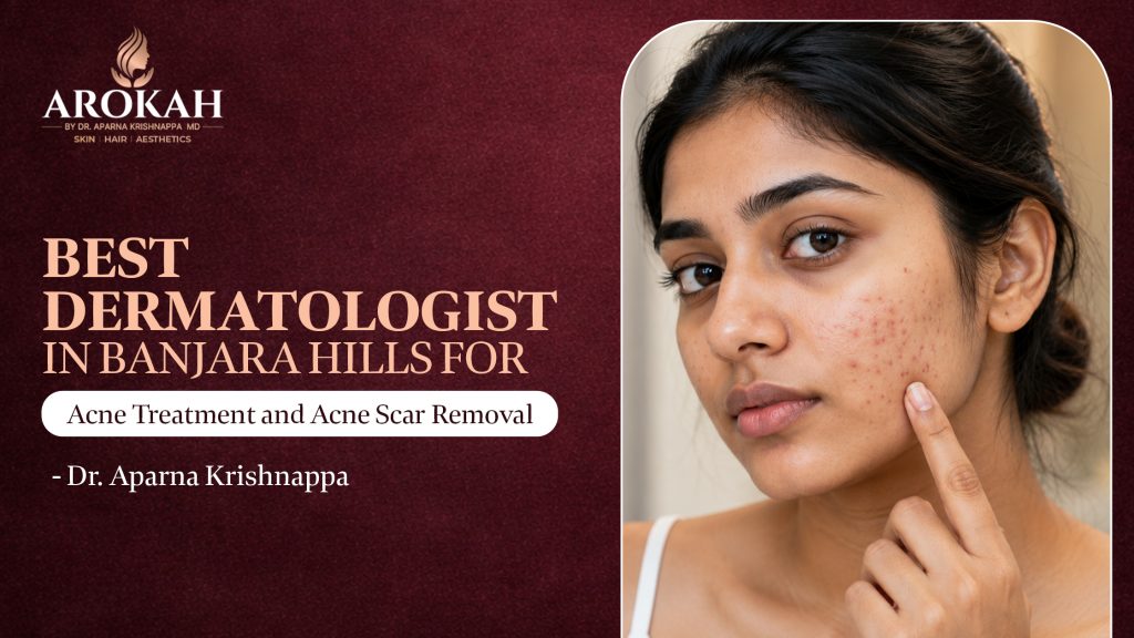 Best Dermatologist in Banjara Hills for Acne Treatment