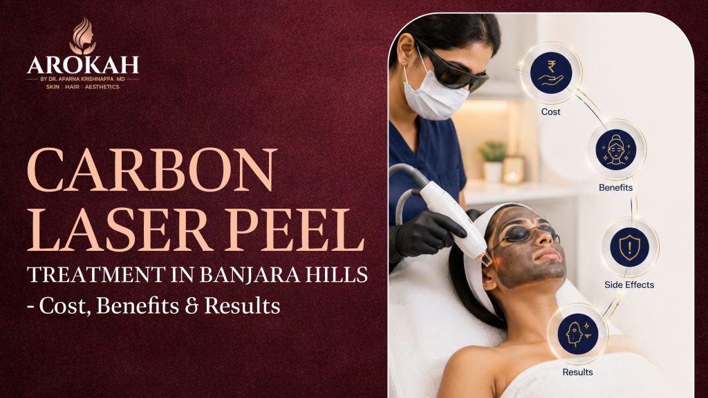 Carbon Laser Peel Treatment in Banjara Hills