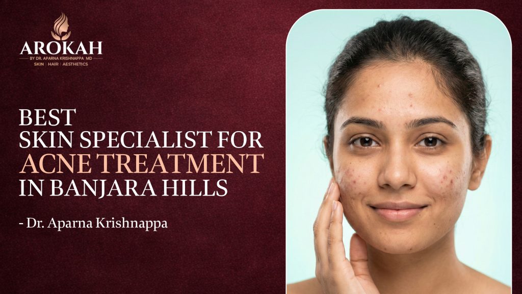 Best Skin Specialist for Acne Treatment