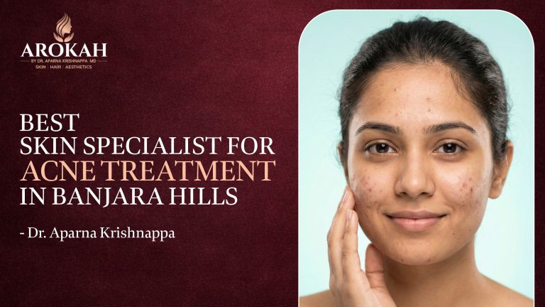 Best Skin Specialist for Acne Treatment In Banjara Hills – Dr. Aparna Krishnappa