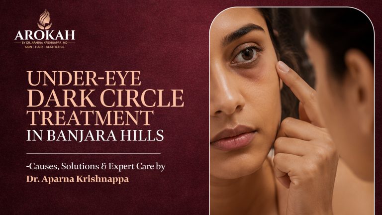 Under-Eye Dark Circle Treatment in Banjara Hills – Causes, Effective Treatments & Expert Care by Dr Aparna Krishnappa