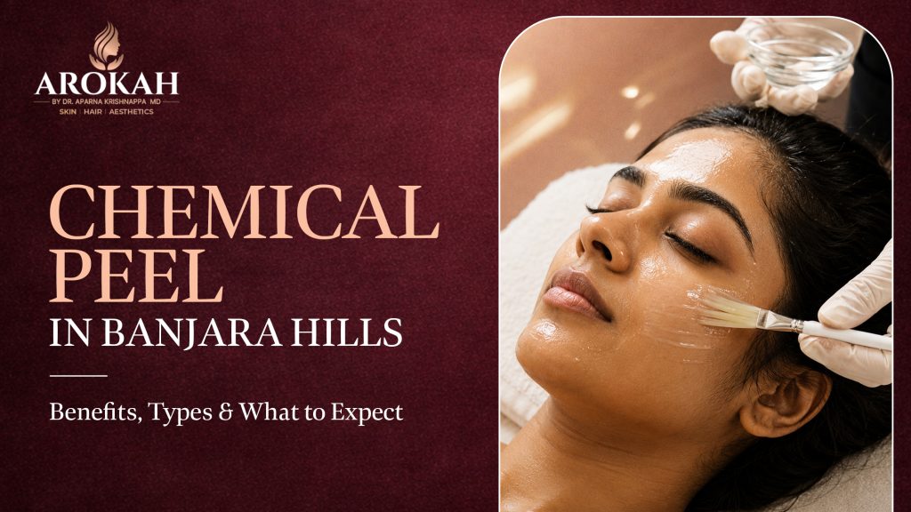 Chemical Peel in Banjara Hills