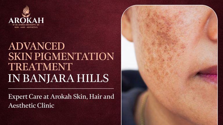 Advanced Skin Pigmentation Treatment in Banjara Hills – Expert Care at Arokah Skin, Hair & Aesthetic Clinic