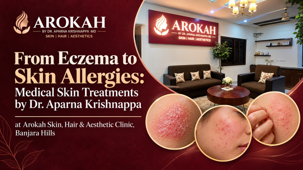 Eczema & Skin Allergy Treatment in Banjara Hills